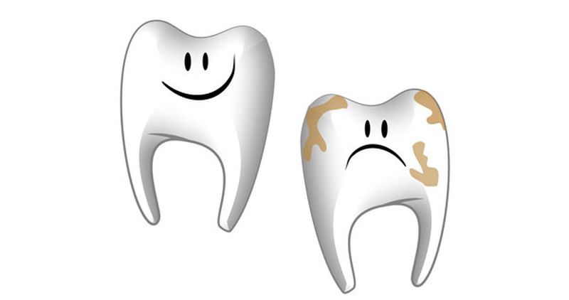 К чему снятся Зубы